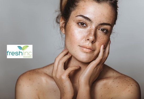 Fresh inc medispa